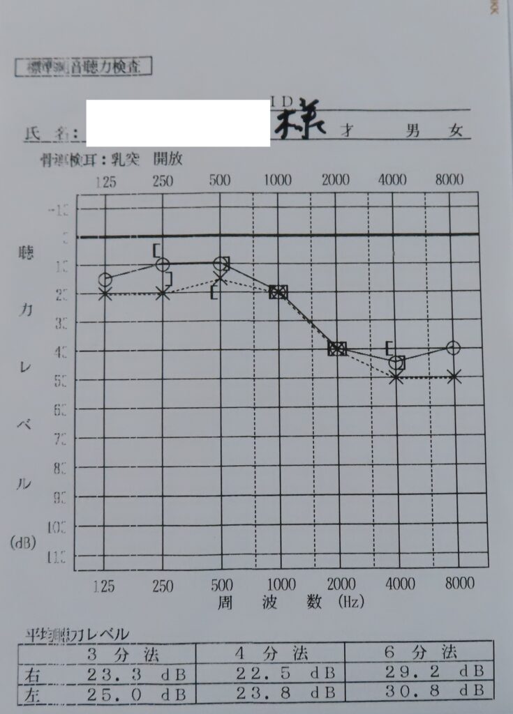 聴力検査